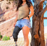 Angelina Martinson with prosthetic
